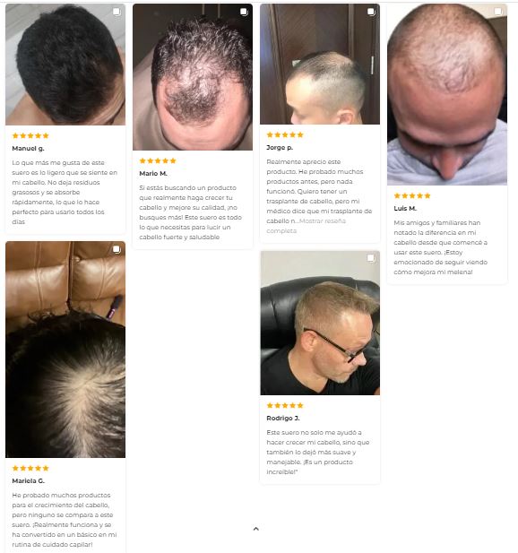OUHOE HAIR™ - SUERO PARA EL CRECIMIENTO DEL CABELLO 🌿🧔