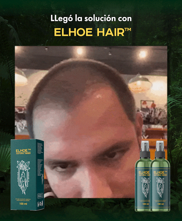 OUHOE HAIR™ - SUERO PARA EL CRECIMIENTO DEL CABELLO 🌿🧔